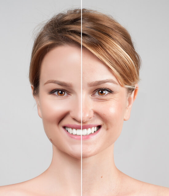 Before-and-after comparison of a smiling woman’s face, highlighting skin improvement and enhanced radiance.