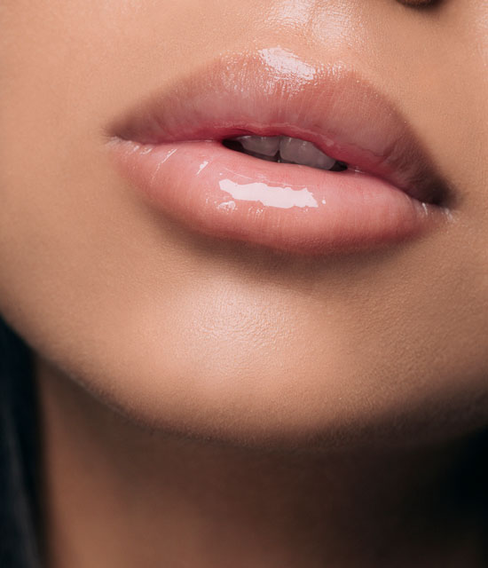 Close-up of of a women with glossy, full lips after using lip fillers