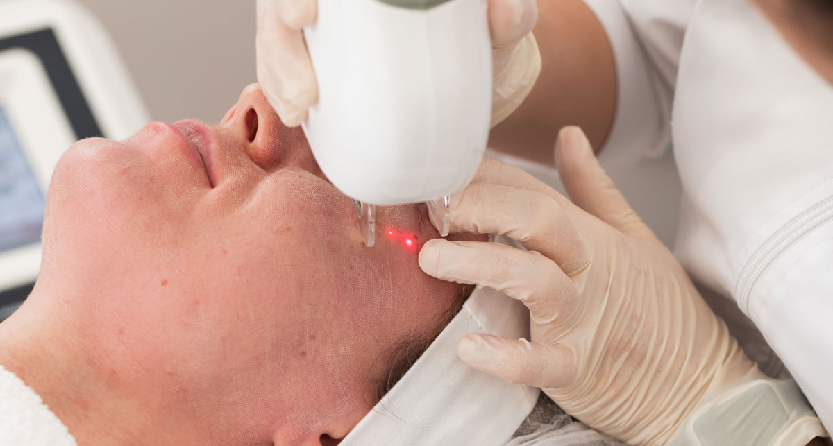 Close-up of a person receiving a facial laser treatment from a professional wearing gloves.