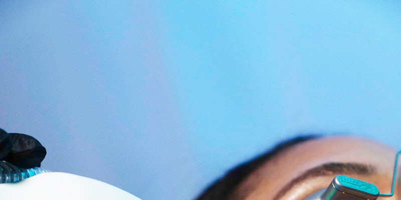 a woman getting halo tribrid on her cheek